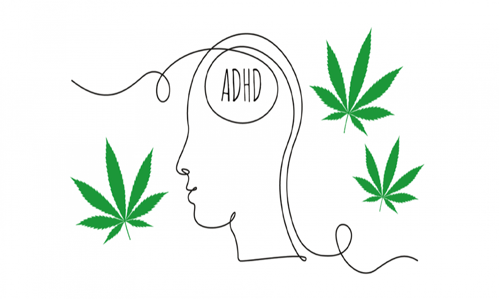ADHD患者、大麻使用で症状改善しQOL向上