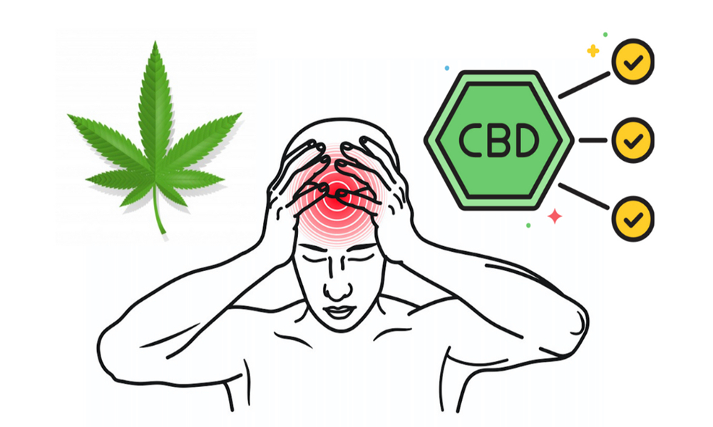 偏頭痛と医療大麻・CBD